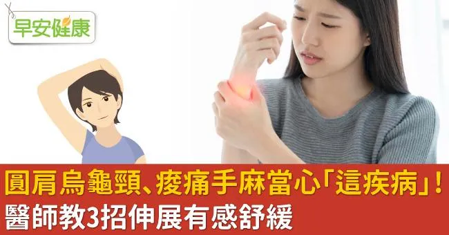 圓肩烏龜頸、痠痛手麻當心「這疾病」！醫師教3招伸展有感舒緩