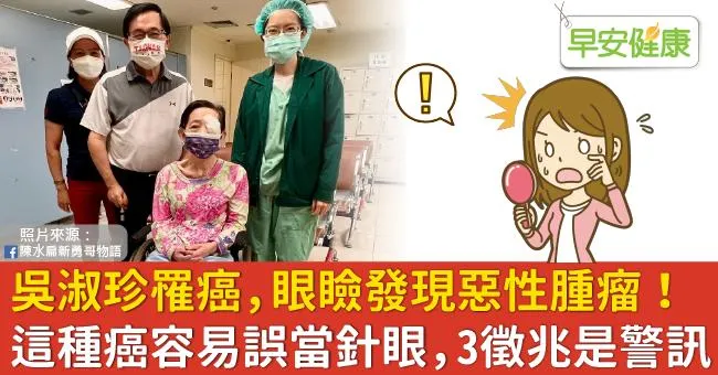 吳淑珍罹癌，眼瞼發現惡性腫瘤！這種癌容易誤當針眼，3徵兆是警訊
