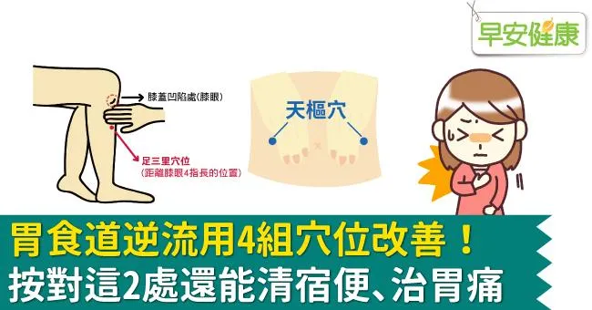 胃食道逆流用4組穴位改善！按對這2處還能清宿便、治胃痛