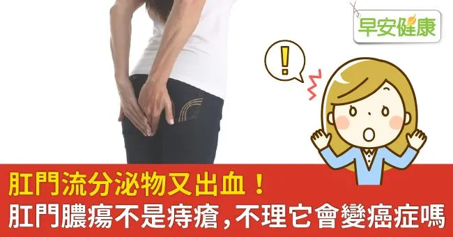 肛門流分泌物又出血！肛門膿瘍不是痔瘡，不理它會變癌症嗎？