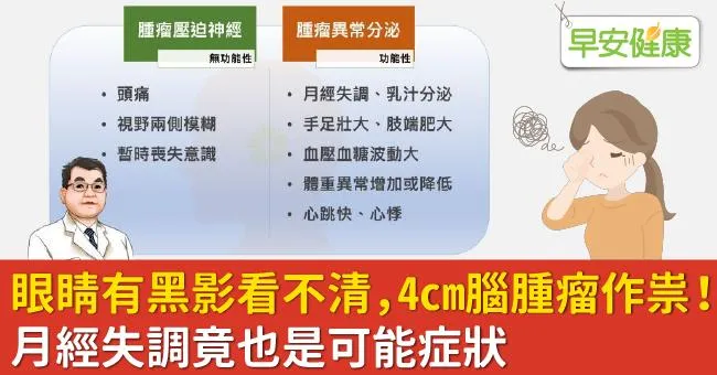 眼睛有黑影看不清，4cm腦腫瘤作祟！月經失調竟也是可能症狀