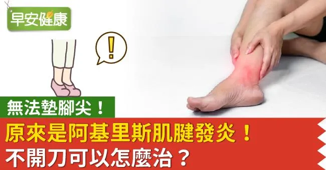 無法墊腳尖！原來是阿基里斯肌腱發炎！不開刀可以怎麼治？