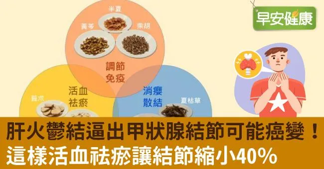 肝火鬱結逼出甲狀腺結節可能癌變！這樣活血祛瘀讓結節縮小40％
