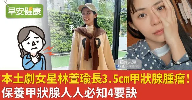本土劇女星林萱瑜長3.5cm甲狀腺腫瘤！保養甲狀腺人人必知4要訣