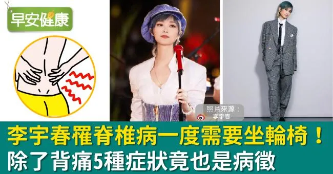 李宇春罹脊椎病一度需要坐輪椅！除了背痛5種症狀竟也是病徵