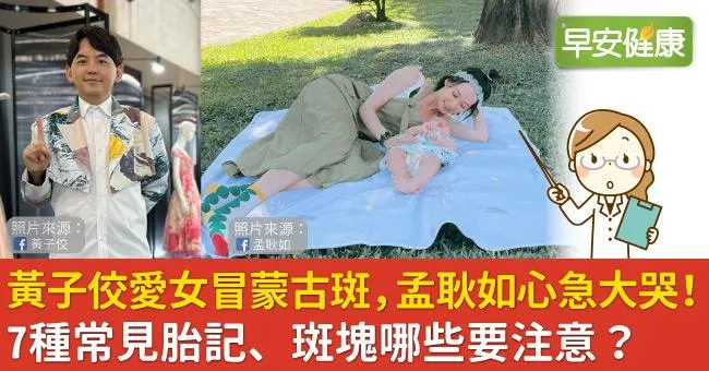 黃子佼愛女冒蒙古斑，孟耿如心急大哭！7種常見胎記、斑塊哪些要注意？