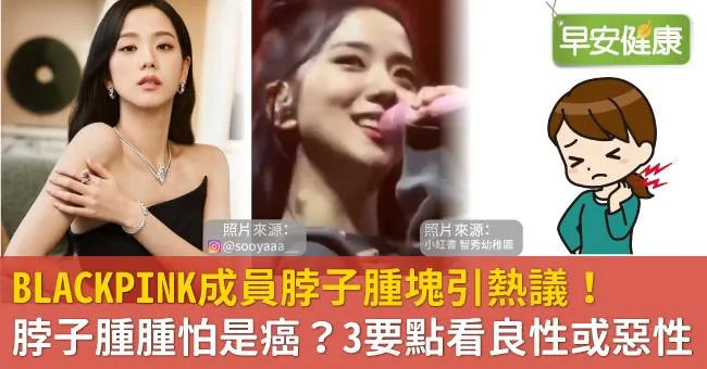 BLACKPINK成員脖子腫塊引熱議！脖子腫腫怕是癌？3要點看良性或惡性
