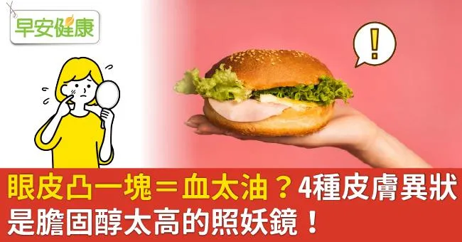眼皮凸一塊＝血太油？4種皮膚異狀，是膽固醇太高的照妖鏡！