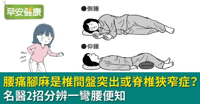 腰痛腳麻是椎間盤突出或脊椎狹窄症？名醫2招分辨一彎腰便知
