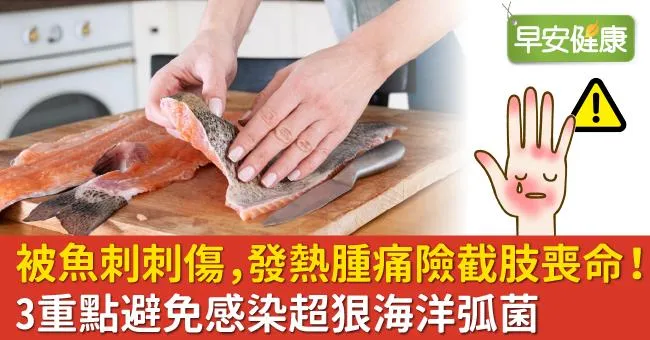 被魚刺刺傷，發熱腫痛險截肢喪命！3重點避免感染超狠海洋弧菌