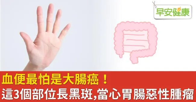 血便最怕是大腸癌！這3個部位長黑斑，當心胃腸惡性腫瘤！