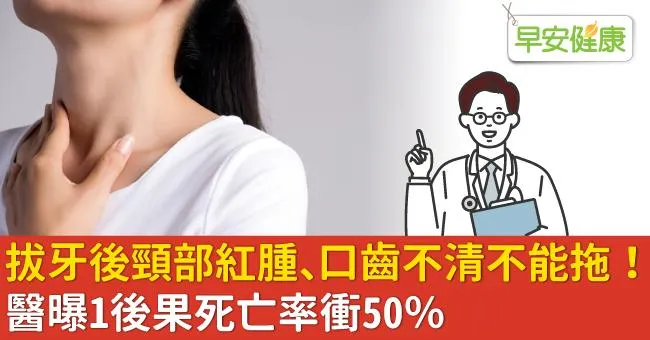 拔牙後頸部紅腫、口齒不清不能拖！醫曝1後果死亡率衝50％