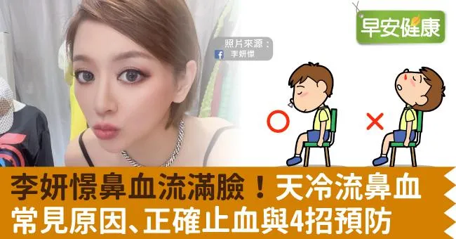 李妍憬鼻血流滿臉！天冷流鼻血常見原因、正確止血與4招預防