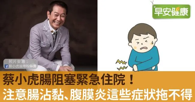 蔡小虎腸阻塞緊急住院！注意腸沾黏、腹膜炎這些症狀拖不得