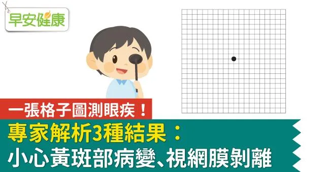 一張格子圖測眼疾！看到3種結果小心黃斑部病變、視網膜剝離