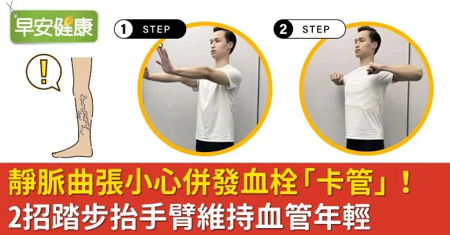 靜脈曲張小心併發血栓「卡管」！2招踏步抬手臂維持血管年輕
