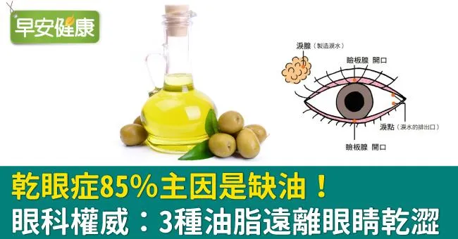 乾眼症85％主因是缺油！國際眼科名醫：3種油脂遠離眼睛乾澀