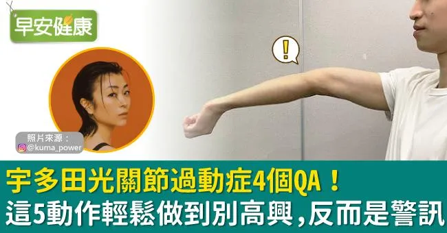 宇多田光關節過動症4個QA！這5動作輕鬆做到別高興，反而是警訊