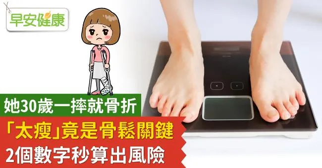 她30歲一摔就骨折「太瘦」竟是骨鬆關鍵！2個數字秒算出風險