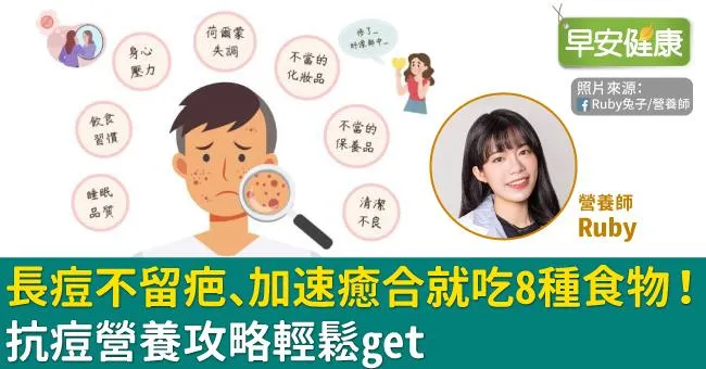 青春痘不只發生在青春期！台大醫師4招搭配治療避免留疤