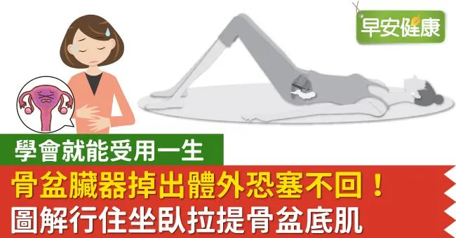 骨盆臟器掉出體外恐塞不回 圖解行住坐臥拉提骨盆底肌 學會就能受用一生