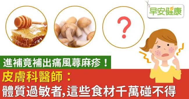 進補竟補出痛風蕁麻疹！皮膚科醫師：體質過敏者，這些食材千萬碰不得