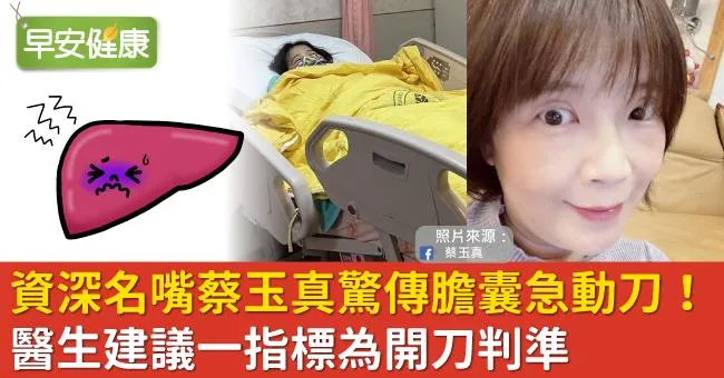 資深名嘴蔡玉真驚傳膽囊急動刀！醫生建議一指標為開刀判準