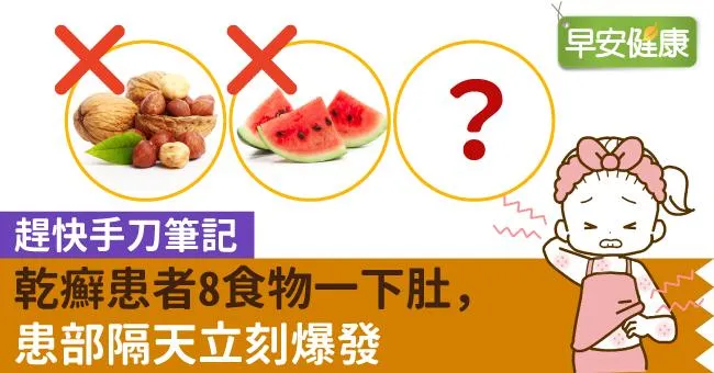趕快手刀筆記！乾癬患者8食物一下肚，患部隔天立刻爆發