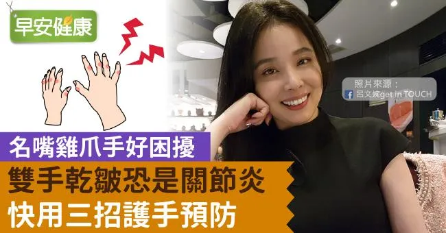 名嘴雞爪手好困擾！雙手乾皺恐是關節炎，快用三招護手預防
