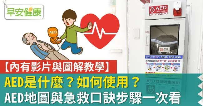 AED是什麼？從使用口訣與步驟，到查詢AED地圖場所，急救時機完整教學一次看