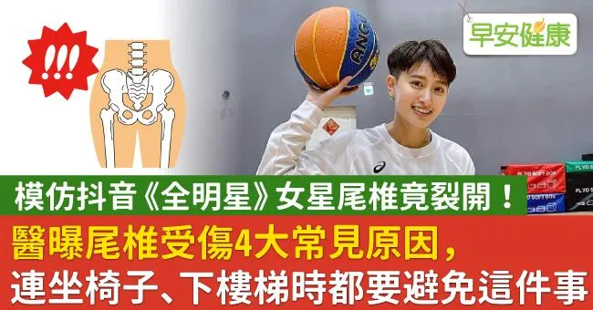 《全明星》女星模仿抖音，尾椎竟裂開！醫曝尾椎受傷4大原因，坐椅子、下樓梯都要避免這件事