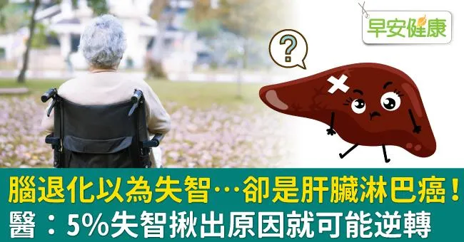 腦退化以為失智…卻是肝臟淋巴癌！醫：5％失智揪出原因就可能逆轉