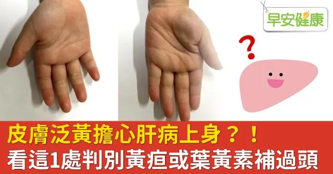 皮膚泛黃擔心肝病上身？看這1處判別黃疸或葉黃素補過頭