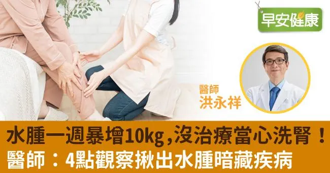 水腫一週暴增10kg，沒治療當心洗腎！醫師：4點觀察揪出水腫暗藏疾病