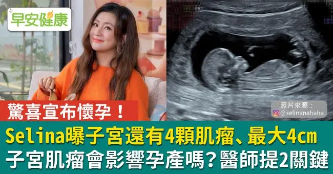 Selina懷孕！苦熬6症狀、4顆子宮肌瘤共存⋯肌瘤不開刀可以嗎？觀察2警訊避癌變
