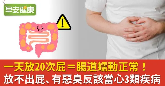 一天放20次屁＝腸道蠕動正常！放不出屁、有惡臭反該當心3類疾病