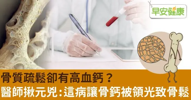 骨質疏鬆卻有高血鈣？醫師揪元兇：這病讓骨鈣被領光致骨鬆