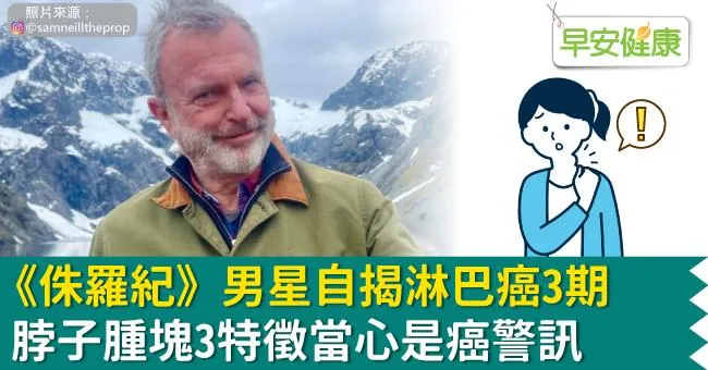 《侏羅紀》男星自揭淋巴癌3期 脖子腫塊3特徵當心是癌警訊