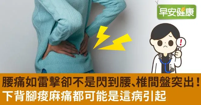 腰痛如雷擊卻不是閃到腰、椎間盤突出！下背腳痠麻痛都可能是這病引起