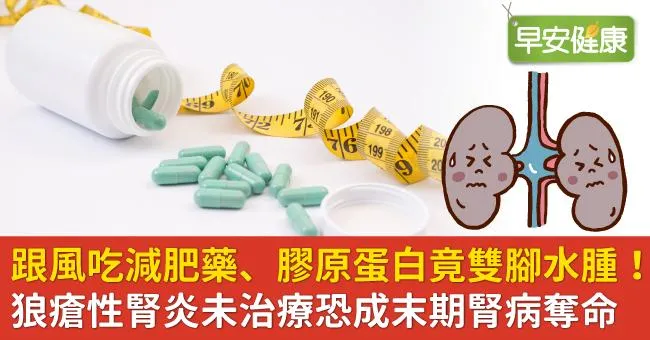 跟風吃減肥藥、膠原蛋白竟雙腳水腫！狼瘡性腎炎未治療恐成末期腎病奪命