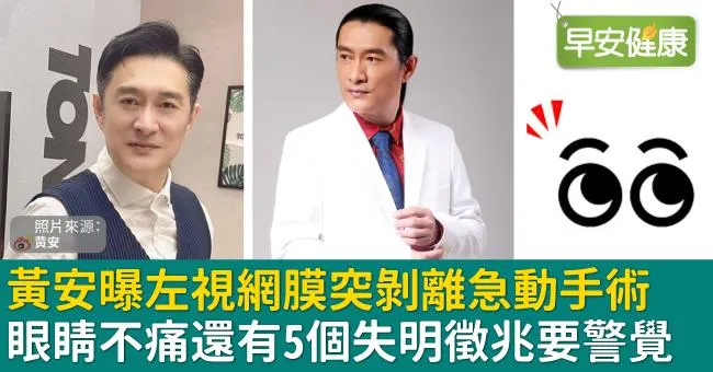 黃安曝左視網膜突剝離急動手術。眼睛不痛還有5個失明徵兆要警覺