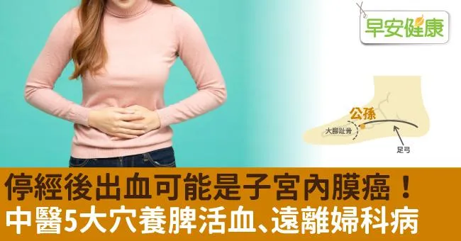 停經後出血可能是子宮內膜癌！中醫5大穴養脾活血、遠離婦科病