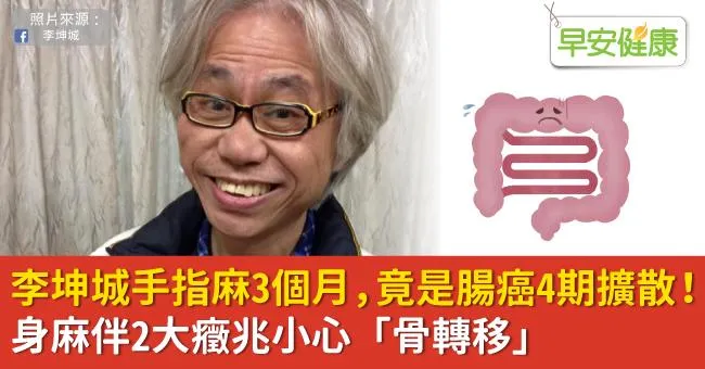 李坤城手指麻3個月，竟是腸癌4期擴散！身麻伴2大癥兆小心「骨轉移」
