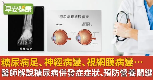 糖尿病足、神經病變、視網膜病變…醫師解說糖尿病併發症症狀、預防營養關鍵