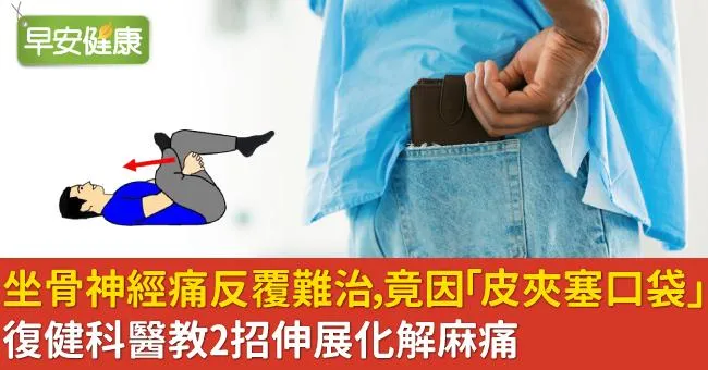 坐骨神經痛反覆難治，竟因「皮夾塞口袋」！復健科醫教2招伸展化解麻痛