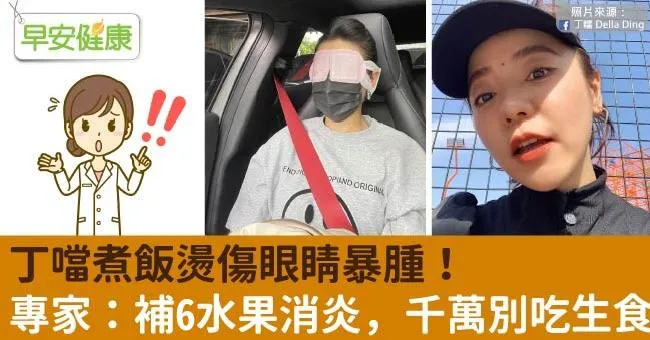 丁噹煮飯燙傷眼睛暴腫！專家：補5水果消炎，千萬別吃生食
