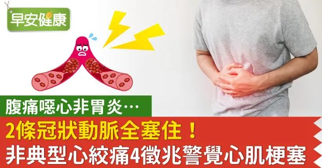 腹痛噁心非胃炎…2條冠狀動脈全塞住！非典型心絞痛4徵兆警覺心肌梗塞