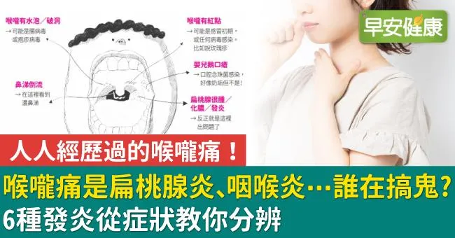 喉嚨痛原因是扁桃腺發炎或咽喉炎？6種發炎從症狀教你分辨