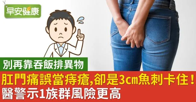 肛門痛誤當痔瘡，卻是3cm魚刺卡住！醫警示1族群風險更高