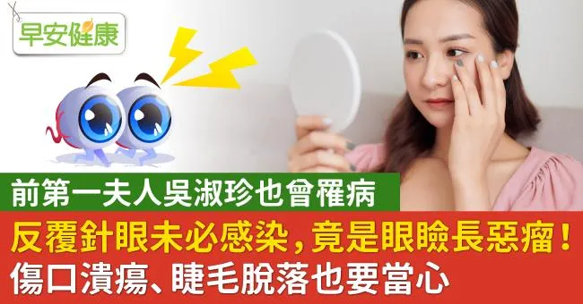 反覆針眼未必感染，竟是眼瞼長惡瘤！傷口潰瘍、睫毛脫落也要當心